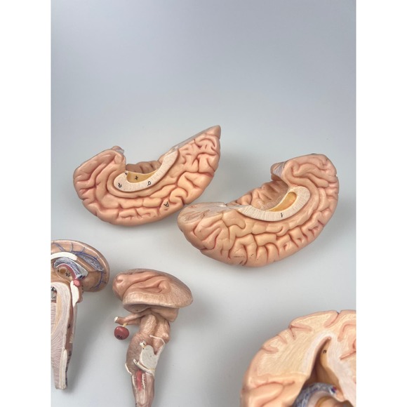 Vintage Somso Germany Anatomical Teaching Model | Human Brain | 6 Parts | Oddity - Picture 8 of 9